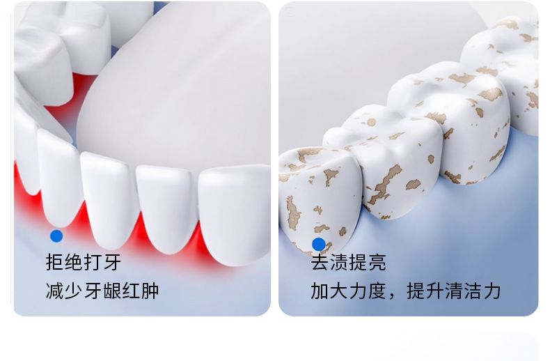 Smart sonic electric toothbrush, rechargeable, soft bristles