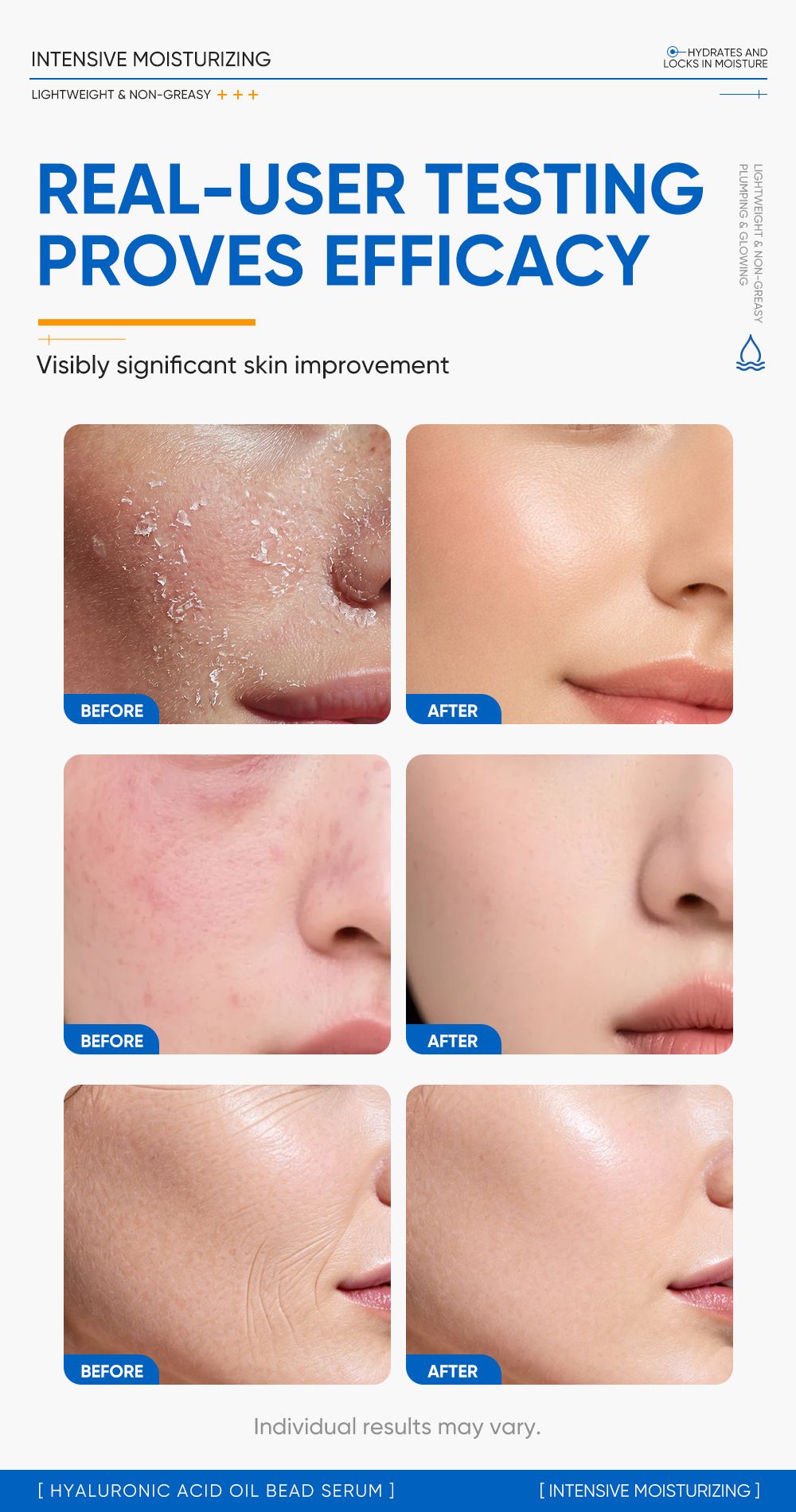 Hyaluronsäure-Öltropfen Serum Barrierenreparatur glättend feuchtigkeitsspendend