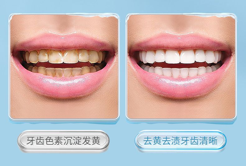GECOMO tooth cleaning brush, portable