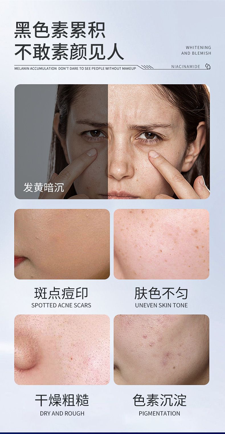 Niacinamide 377 beyazlatıcı serum, hyaluronik asit, leke giderici