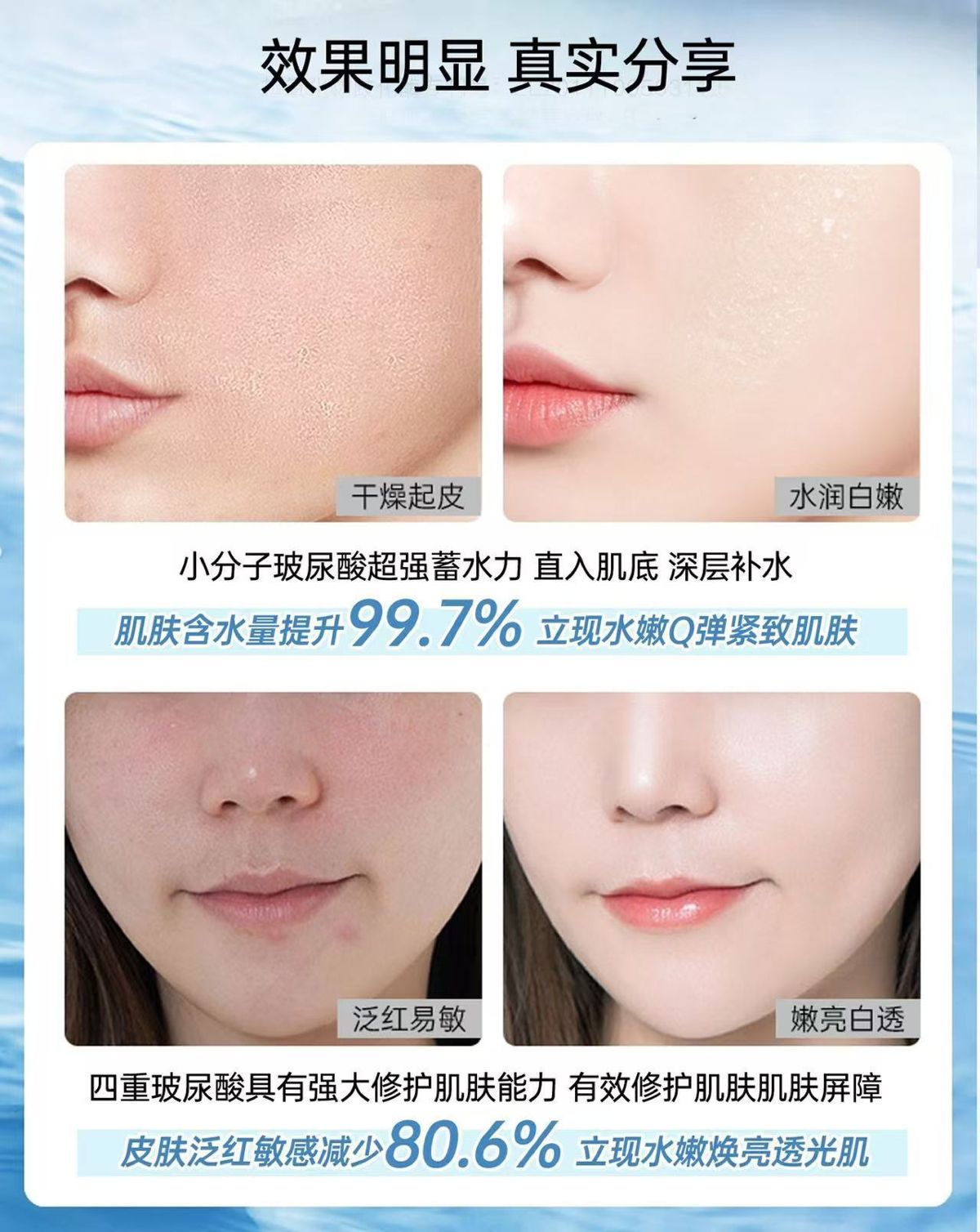 正品芮拉奥高纯度玻尿酸精华液滋润提亮精华美容院湿敷水疗批发