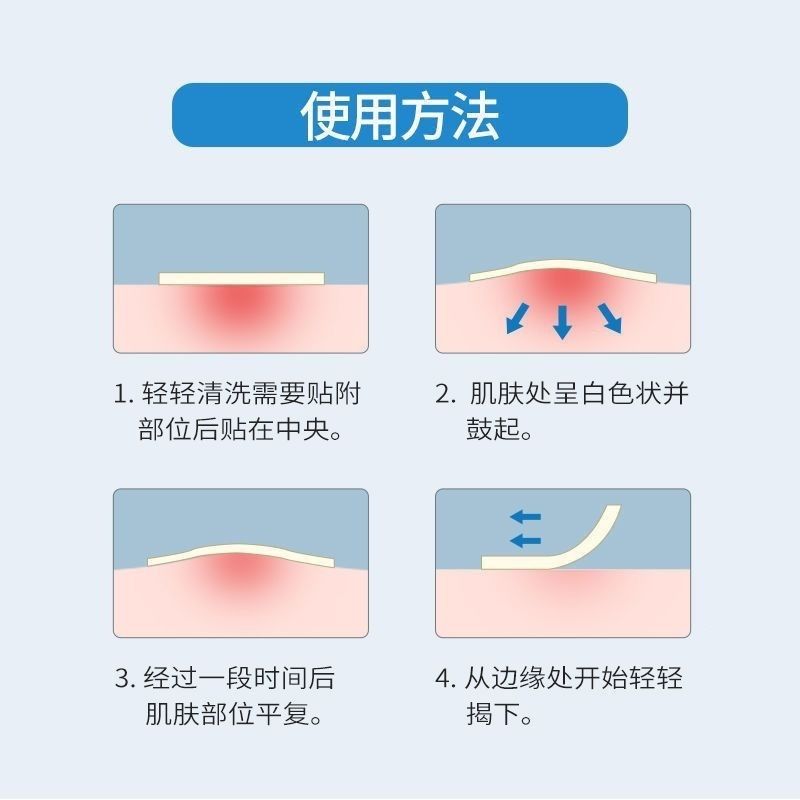 保真正品韩国OliveYoung欧利芙洋痘痘贴隐形净痘贴遮瑕痘印102贴