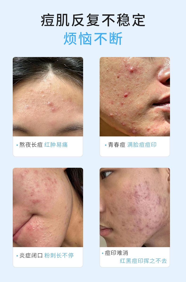 厂家跨境痘痘贴批发彩色卡通蝴蝶防水PE24粒20粒蝴蝶卡通痘痘贴