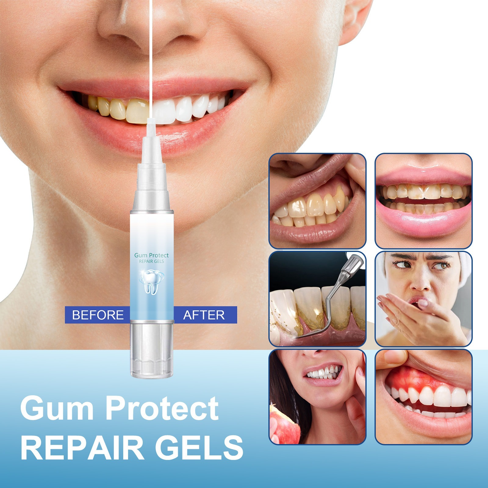 Gum Protect tooth whitening and cleaning pen