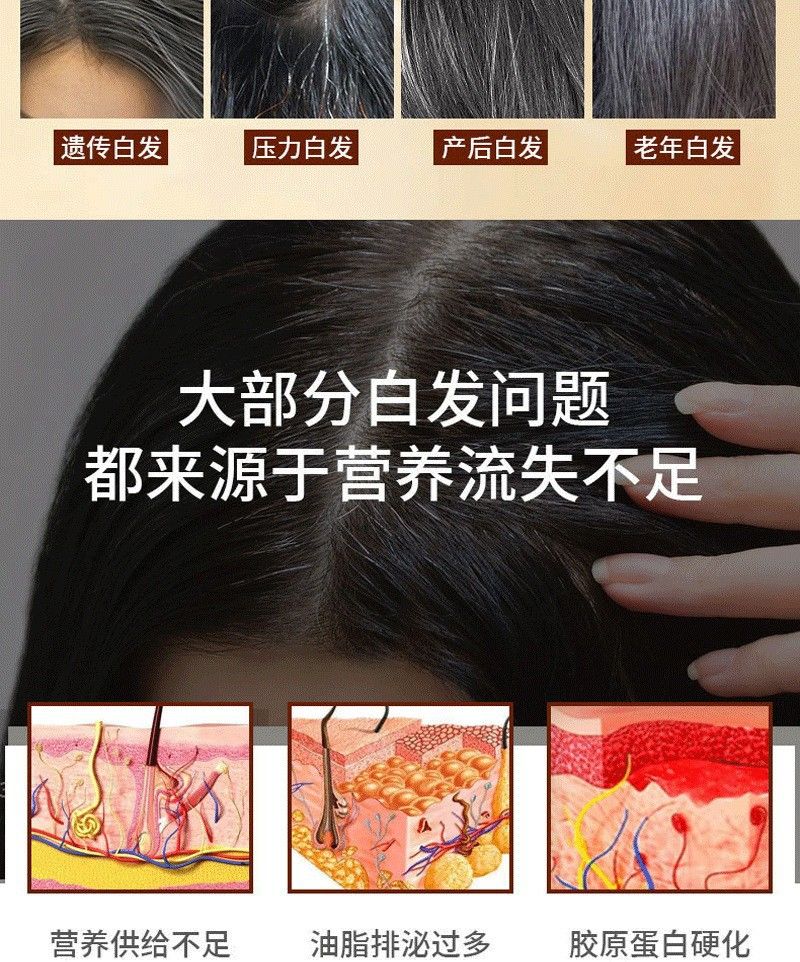 何首乌白发转黑发精华液滋养毛囊营养液生长发液防脱精华乳育发液