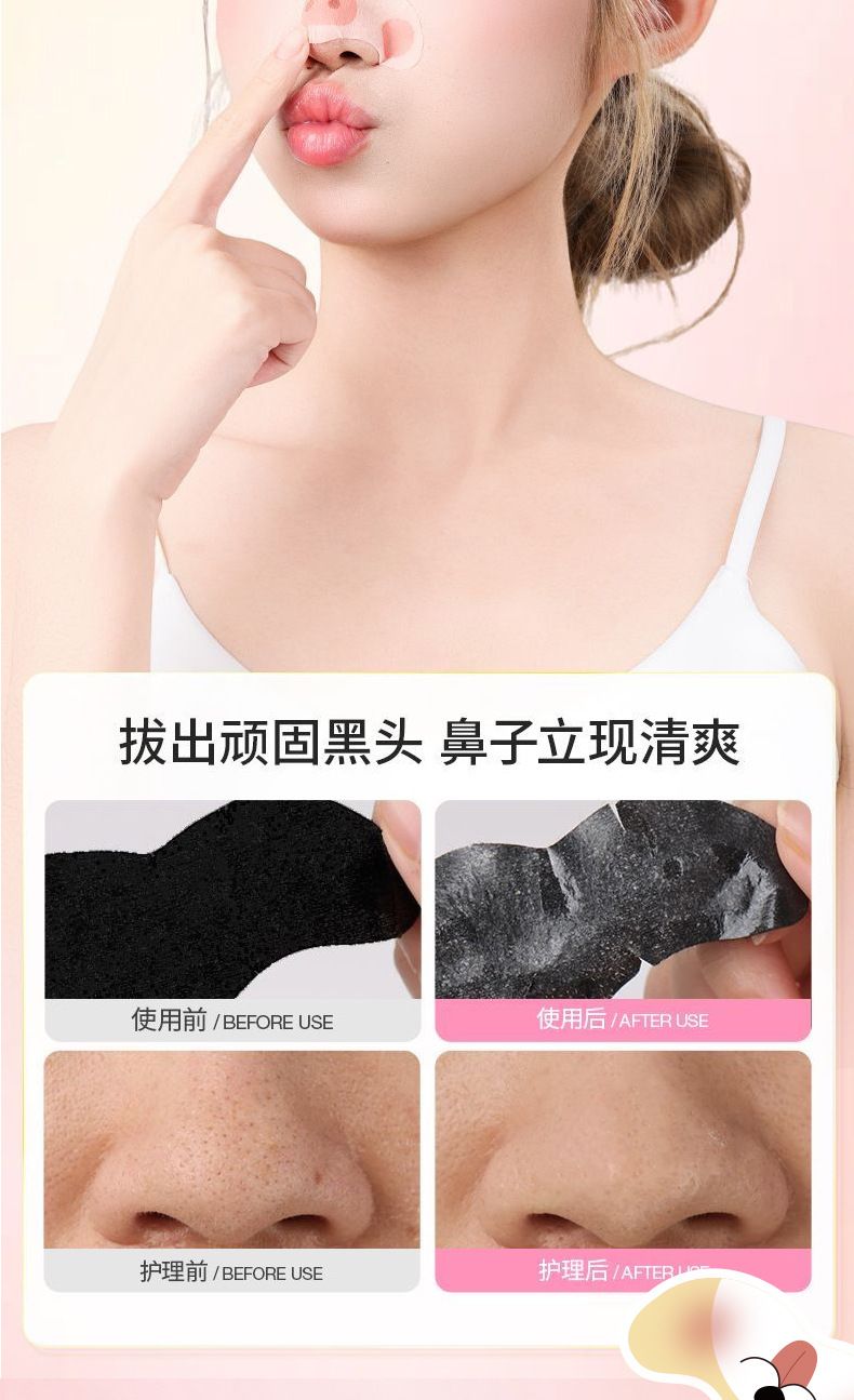 IGUG黑头净澈鼻贴闭口水控油毛孔便携去鼻头贴清洁Q去黑头鼻贴