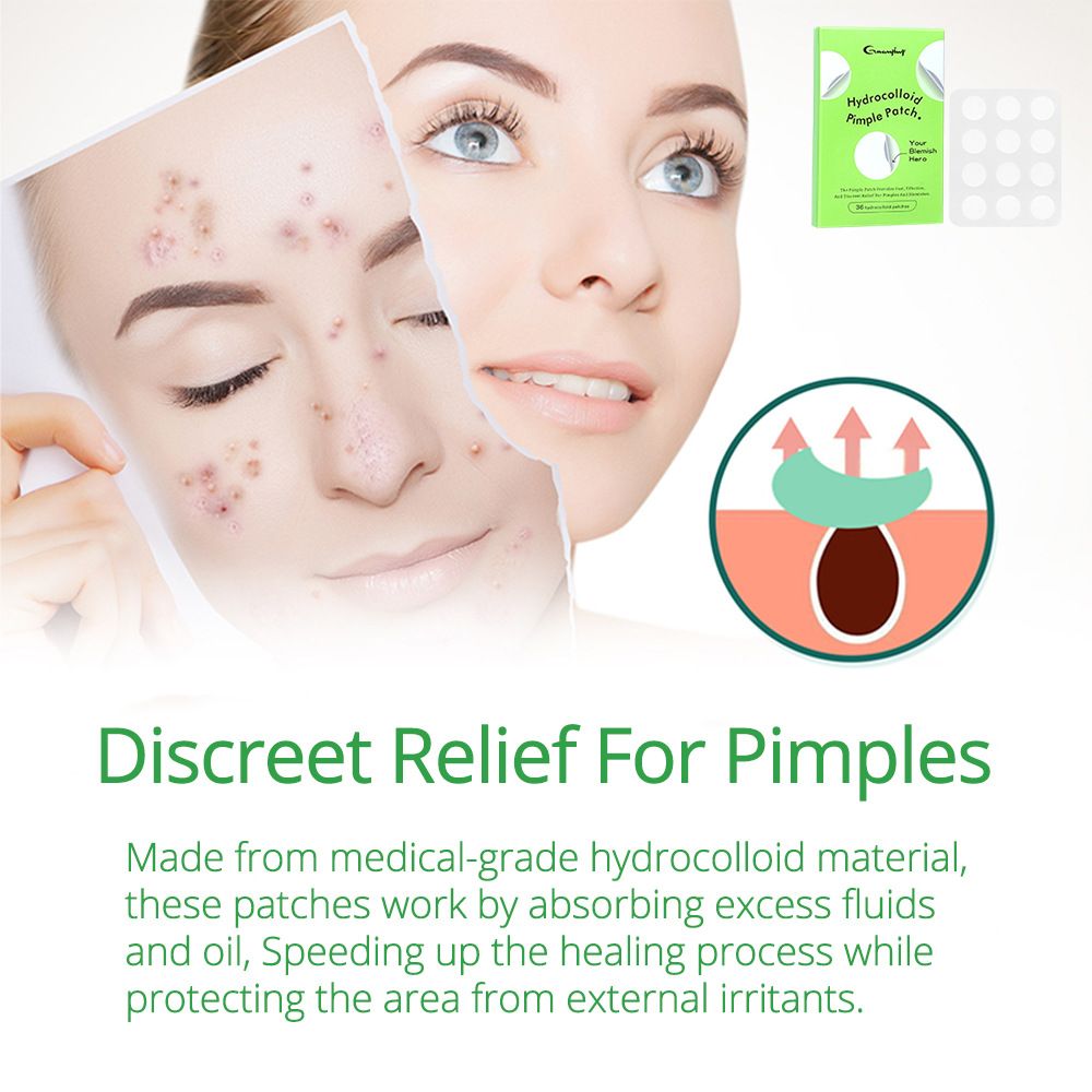 Guanjing acne patch, invisible, breathable