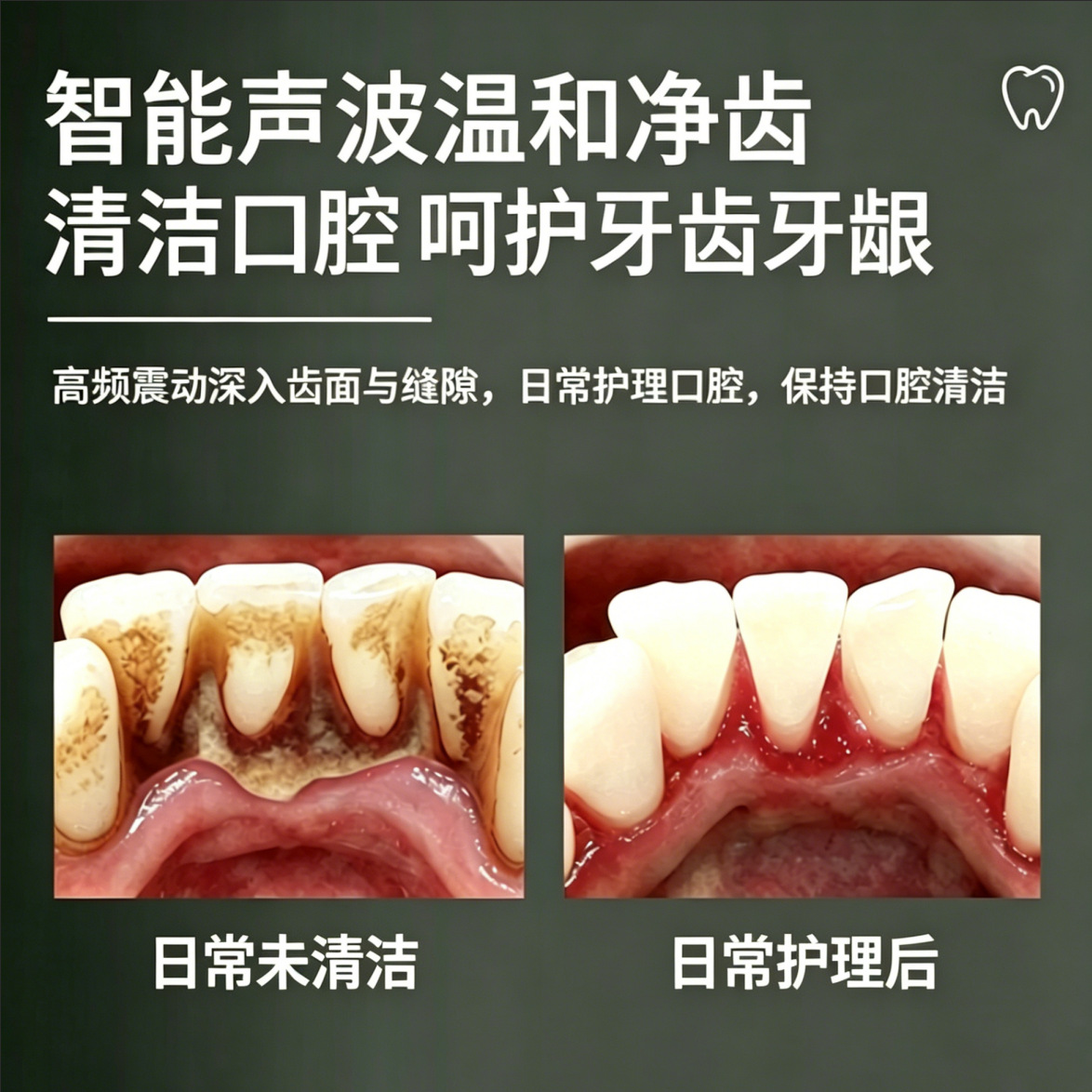 5 vitesli ultrasonik diş temizleyici