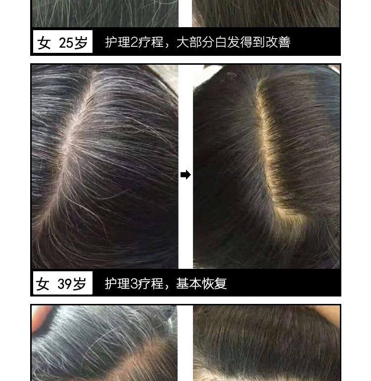 Haarserum gegen Ergrauen Polygonum Multiflorum