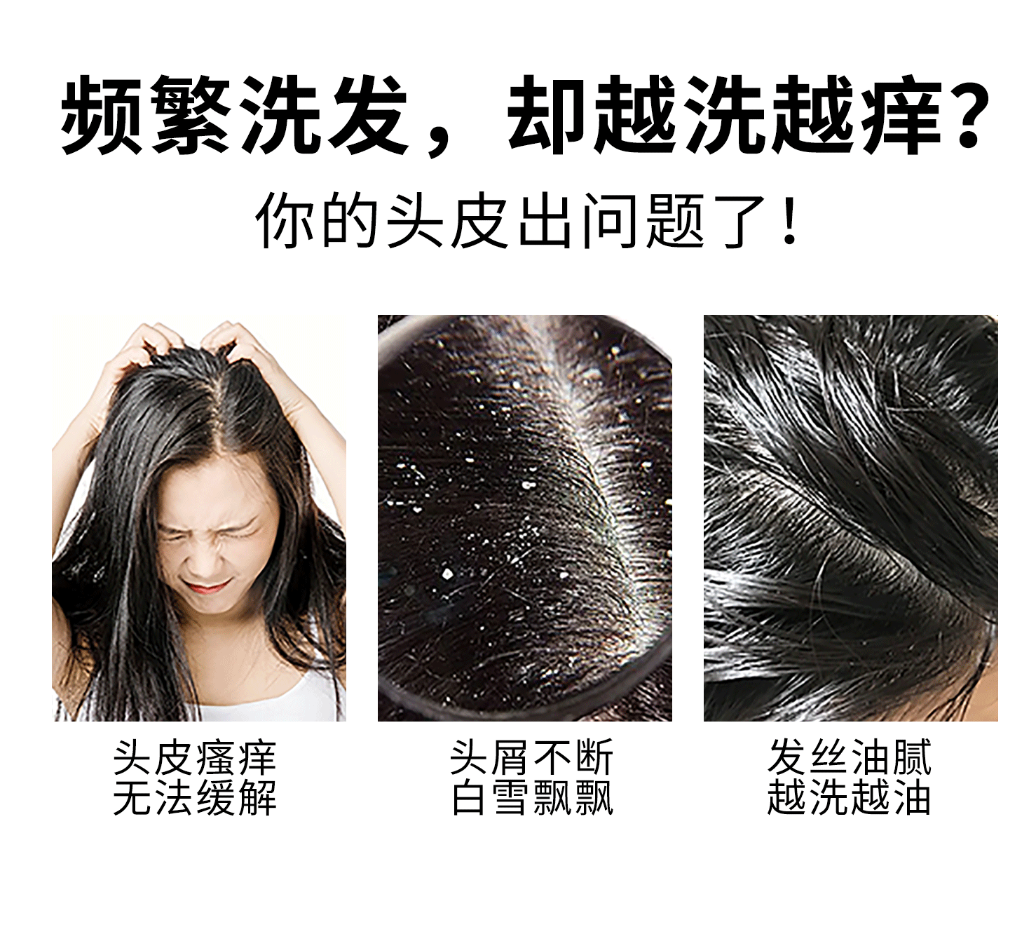 去屑止痒控油洗发水蓬松柔顺滋养洗发露顺滑护发素持久留香沐浴露