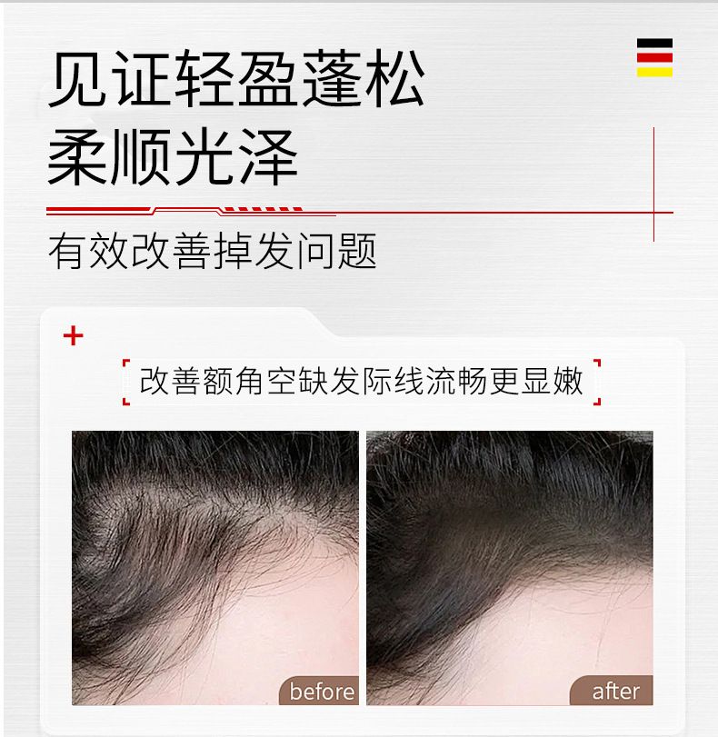 坛南本草防脱精华液激活毛囊头发猛长养发精油营养液草本生育发液