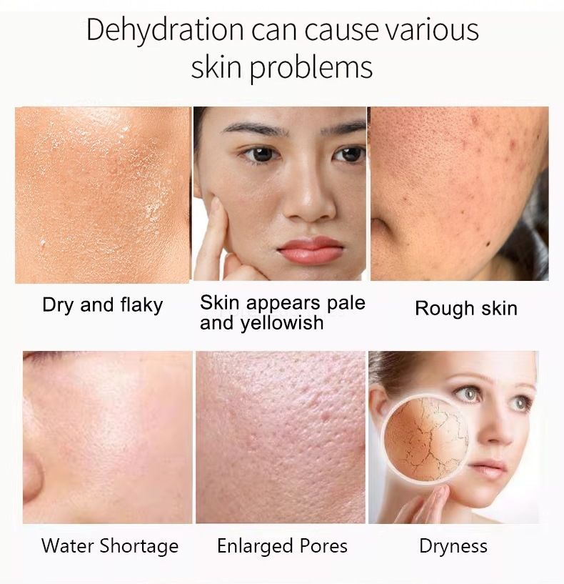 Hyaluronik Asit Nemlendirici Serum, Cilt Parlaklığı Damla