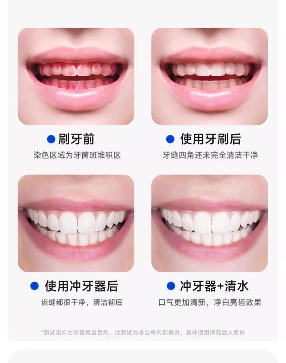 Taşınabilir oral irrigatör, tartar ve plak temizleyici