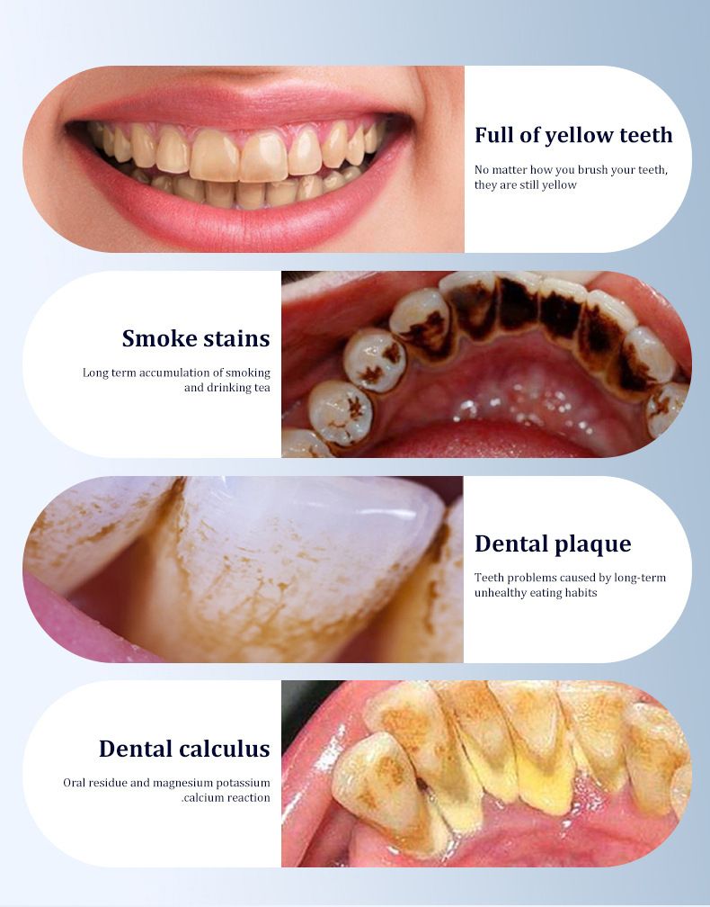 Electric tooth cleaner, multifunctional dental device