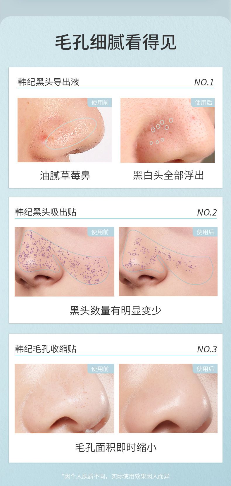 批发祛黑头鼻贴组合毛孔清洁补水保湿去黑头导出液套装护肤厂家
