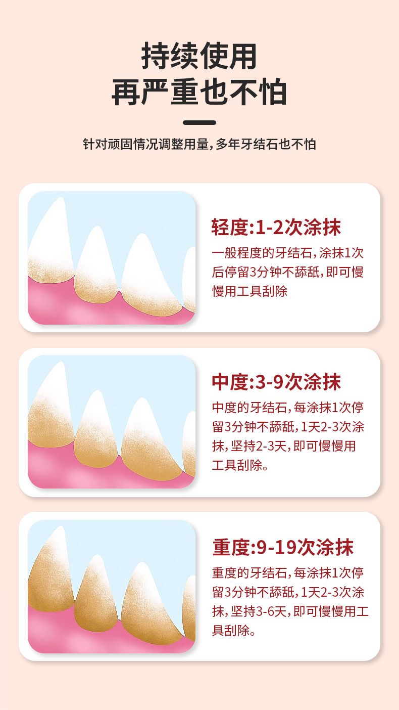宠物洁牙笔猫狗牙结石去除器凝胶工具宠物洁牙笔猫咪口臭牙齿清洁