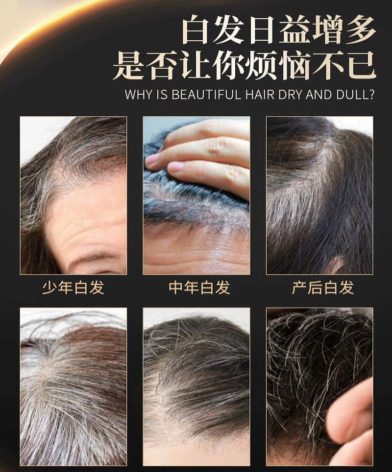 何首乌白发转黑发精华液滋养毛囊营养液生长发液防脱精华乳育发液