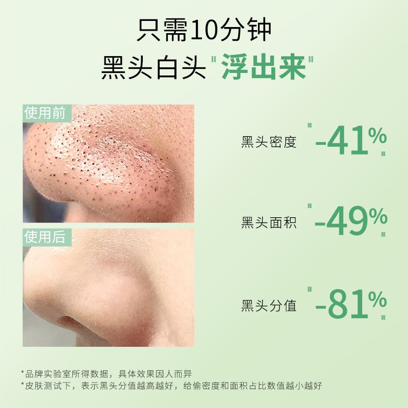 去黑头鼻贴鼻头贴二部曲温和吸黑头粉刺收缩毛孔深层清洁草莓鼻膜