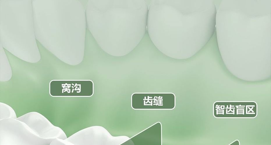 新洁牙器家用电动冲牙器可伸缩牙齿洗牙器充电水牙线冲洗器清洁器