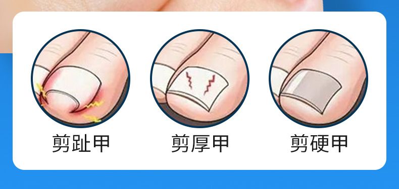 Adlerkopf-Design Fußnagelschere Set professionell