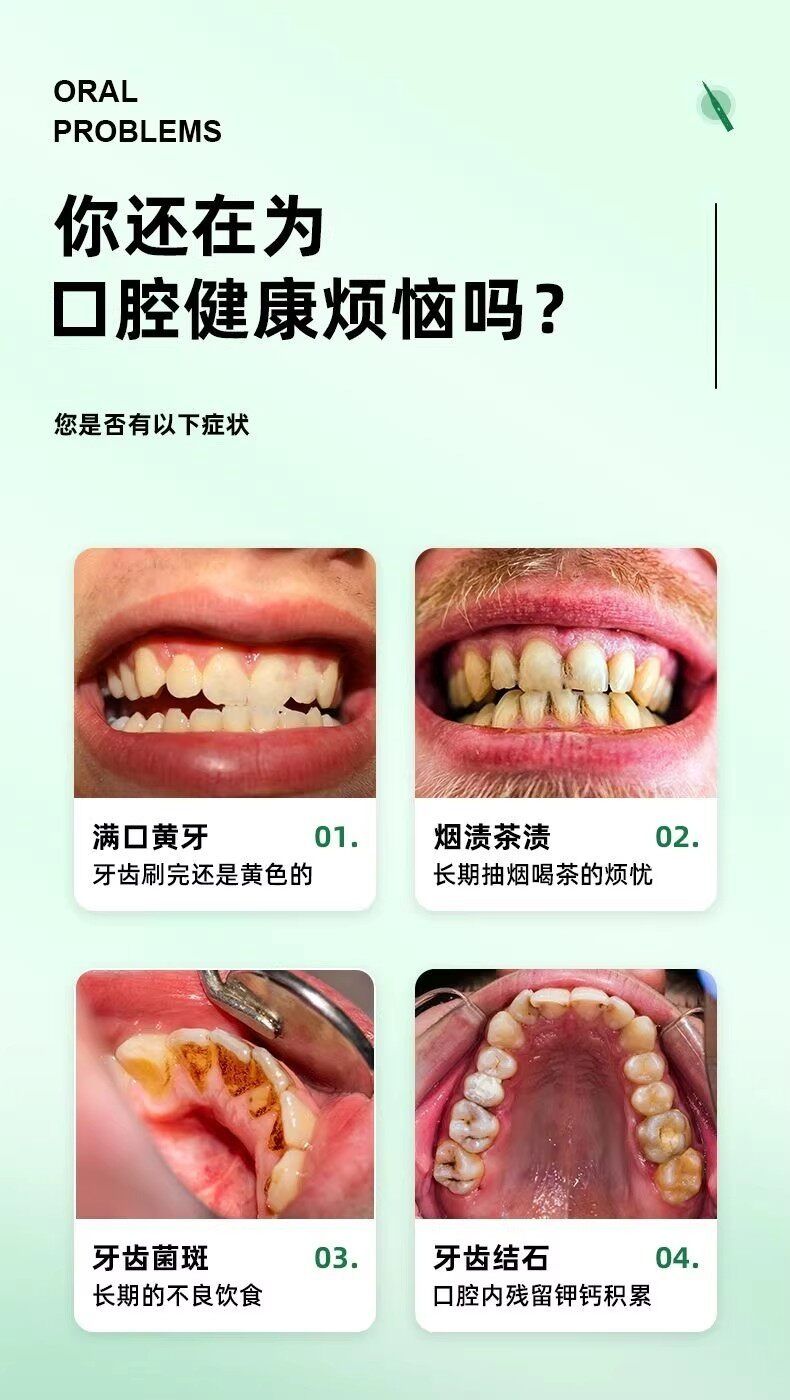洗牙仪超声波牙结石去除器去黄牙垢口臭牙渍神器电动牙刷冲洁牙器