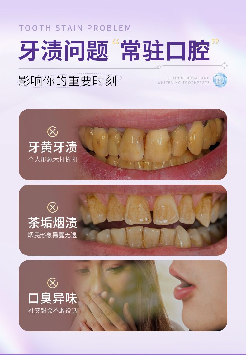 牙科专研去渍美白牙膏清洁牙渍淡黄牙口腔护理清新口气成人牙膏