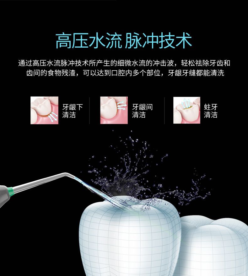 家用冲牙器水压驱动无损安装洁牙器非电池电压驱动环保便携正品