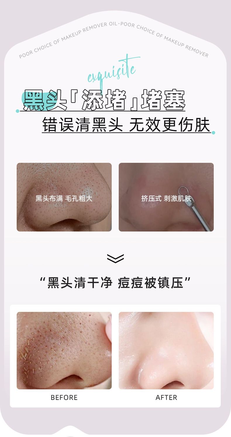 Mingxi bamboo charcoal blackhead nose mask set