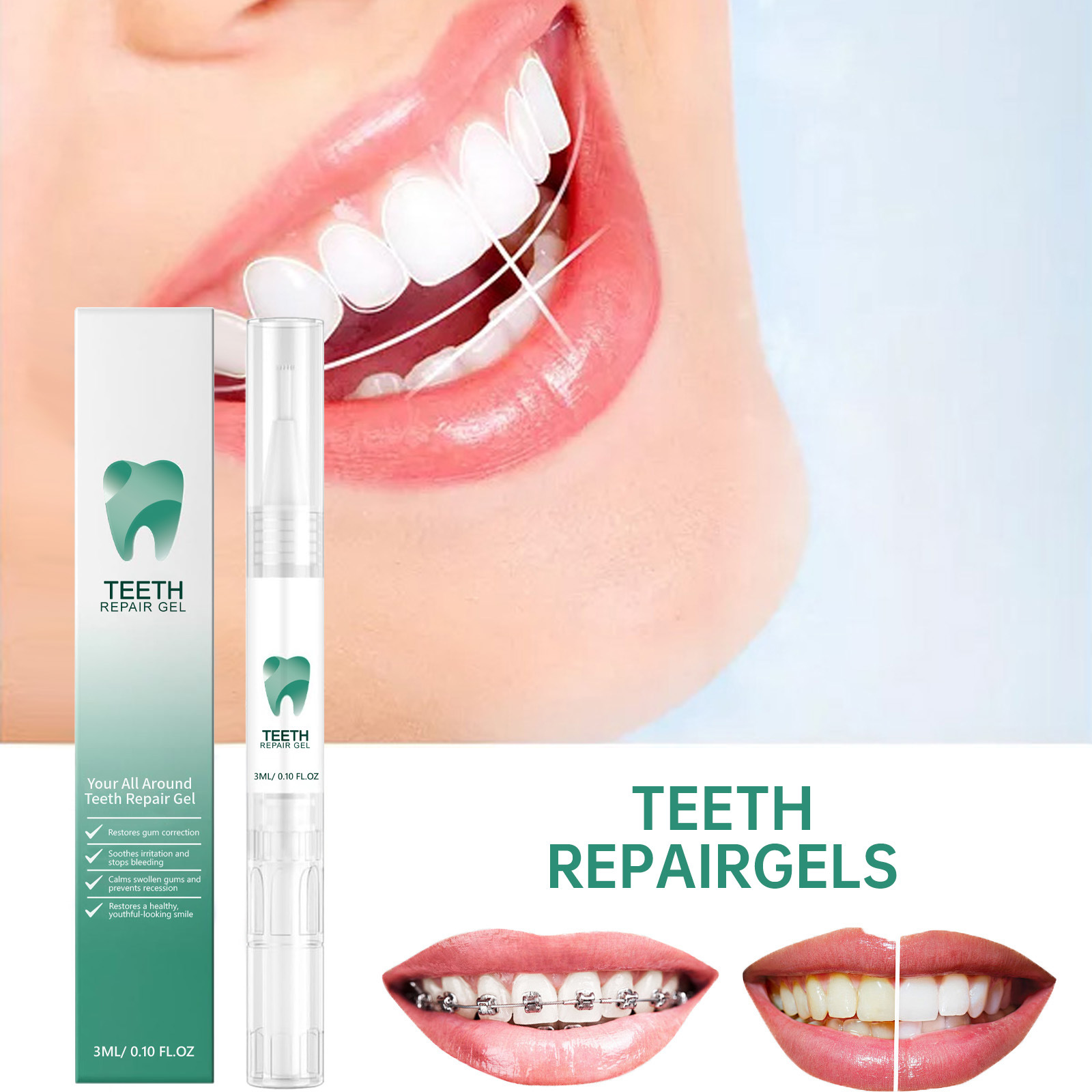 Teeth care gel pen for tartar and stain removal