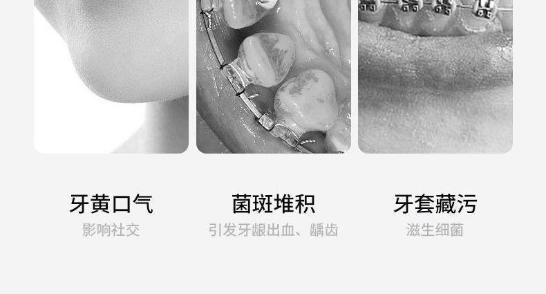超声波高压冲牙器洗牙器便携式家用电动专用正畸水牙线洗牙神器