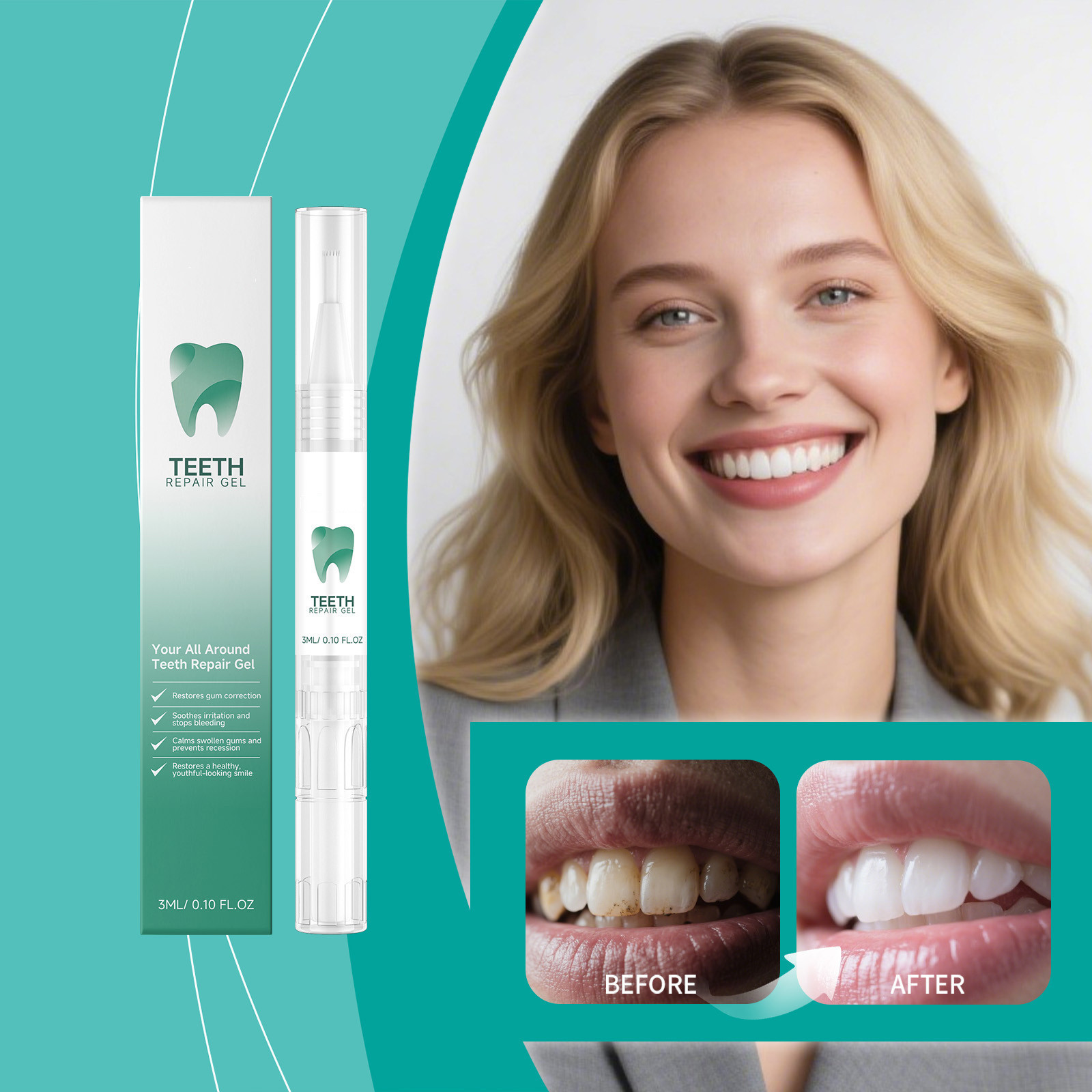 Teeth care gel pen for tartar and stain removal