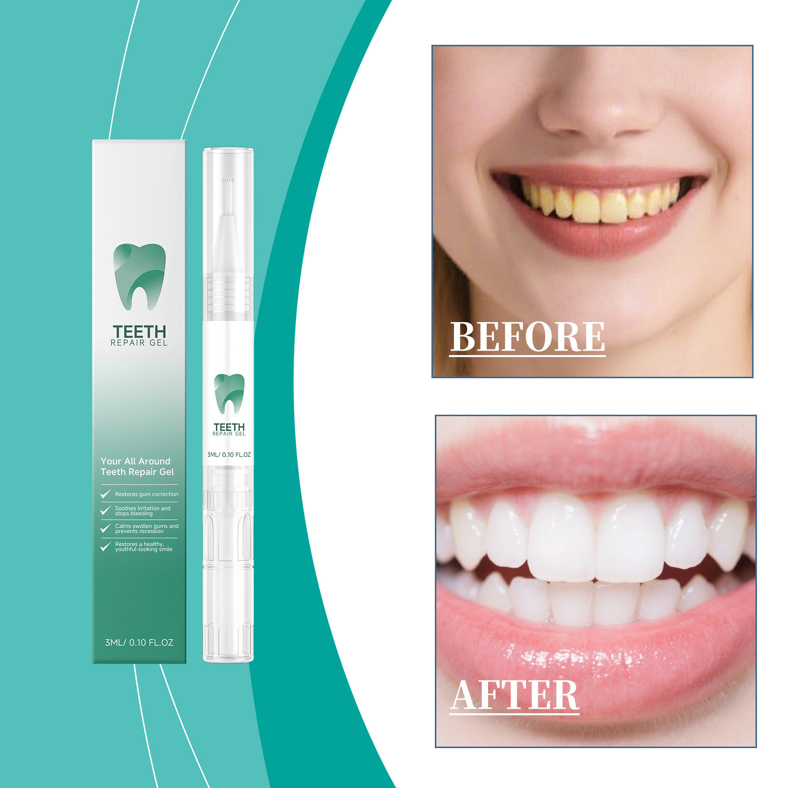 Teeth care gel pen for tartar and stain removal