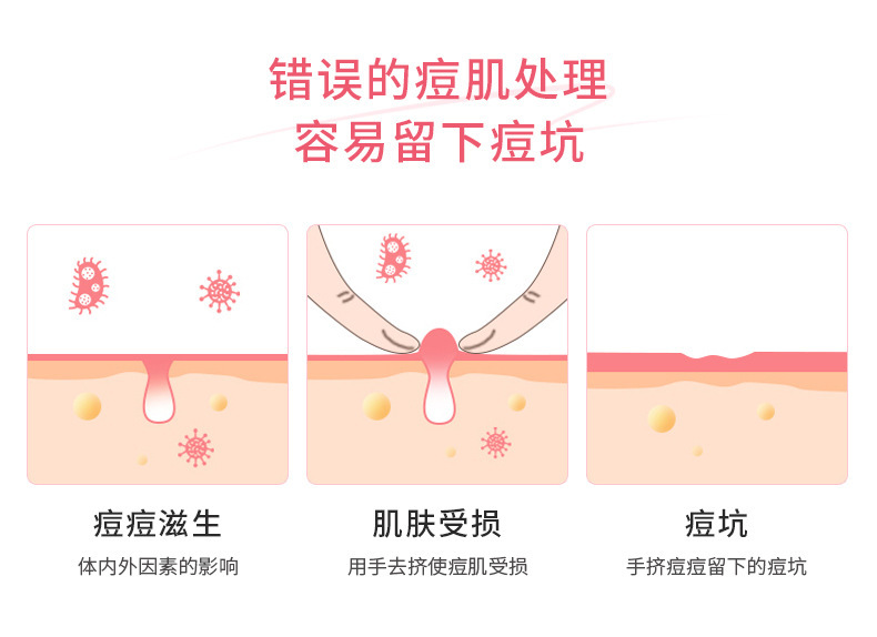 Pimplepatch Heart-Shaped Acne Patches Hydrocolloid Effective