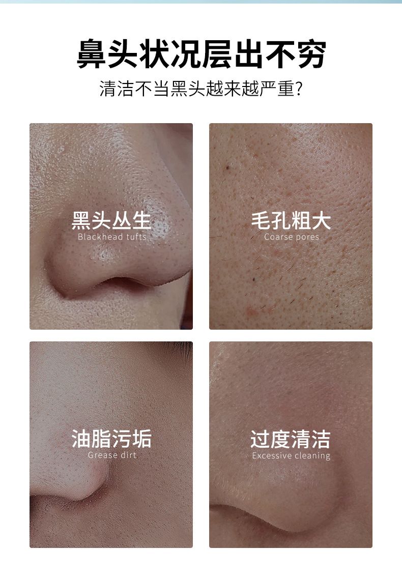 MAIGOOLE nose mask blackhead and acne cleansing pores