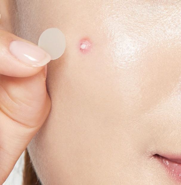 Amazon'un aynı özel şekilli elmaslarla süslenmiş renkli çiçek modeli 20 adet sivilce yaması, taşınabilir, sevimli, cilt dostu hidrojel yamalar