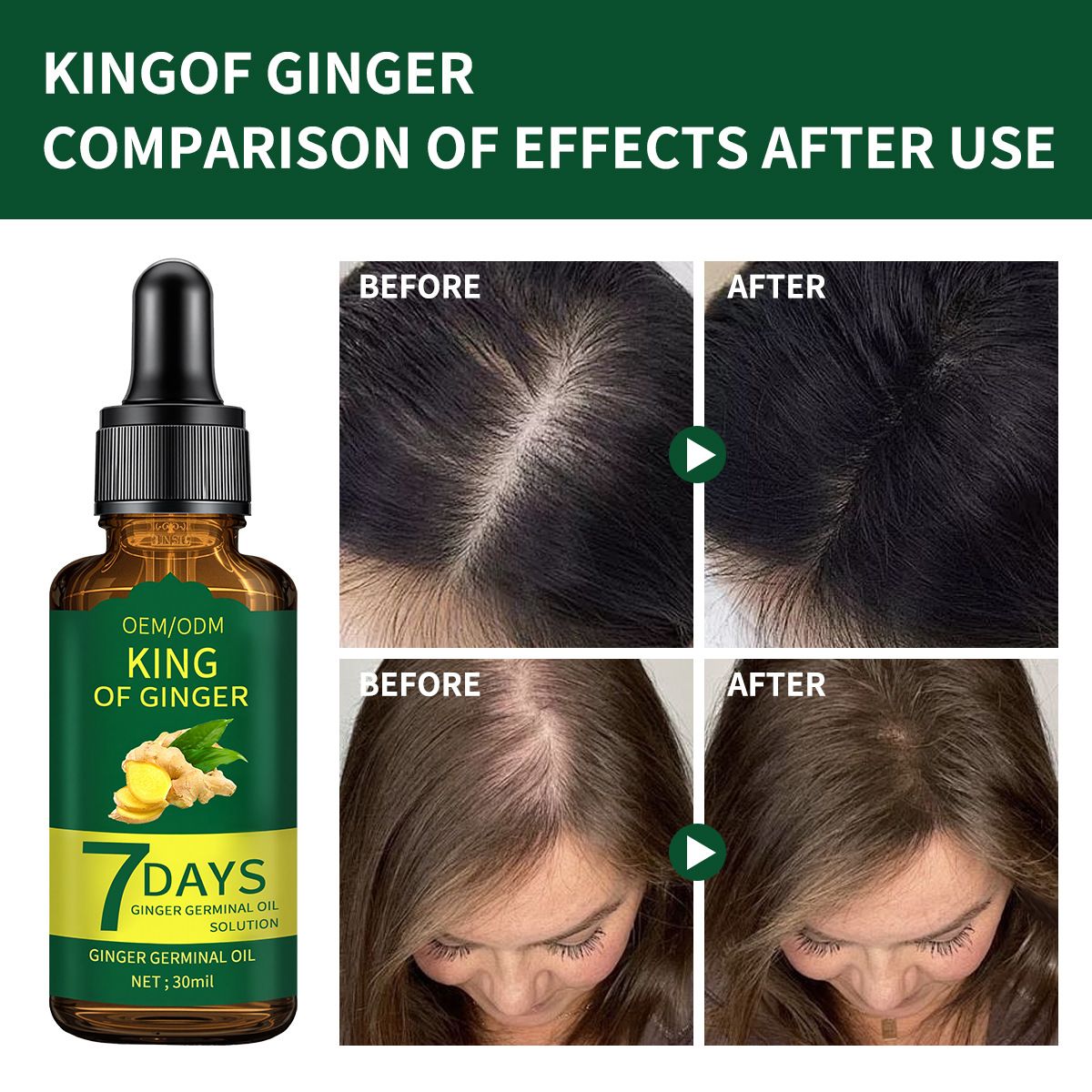 亚马逊爆款生姜Hair growth精华油7天生姜头皮精华液滋养发根 OEM