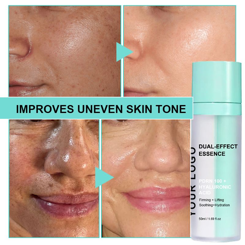 Hyalüronik asit serum, gündüz gece bakım, nemlendir antioksidan