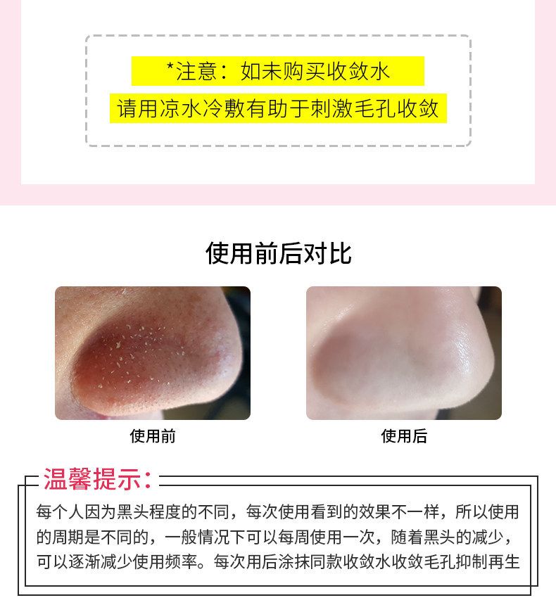 Tayland Siyah Nokta Burun Bantı White Aloe Jel