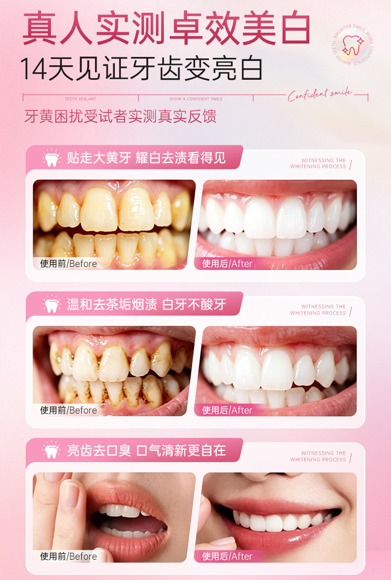 9D Teeth Whitening Strips Self-Adhesive