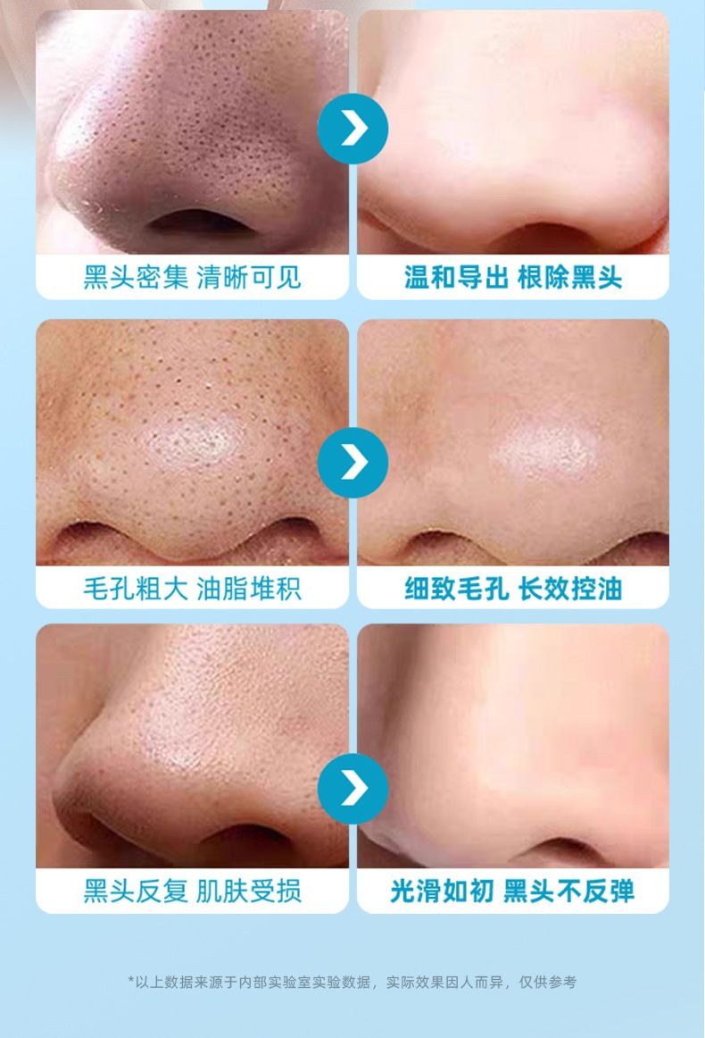 抖音爆款去黑头鼻贴组合收缩毛孔清洁粉刺闭口导出收缩二合一鼻膜