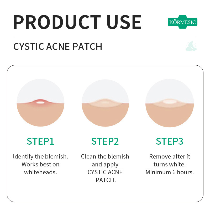 KORMESIC acne patches, facial cleansing and care treatment