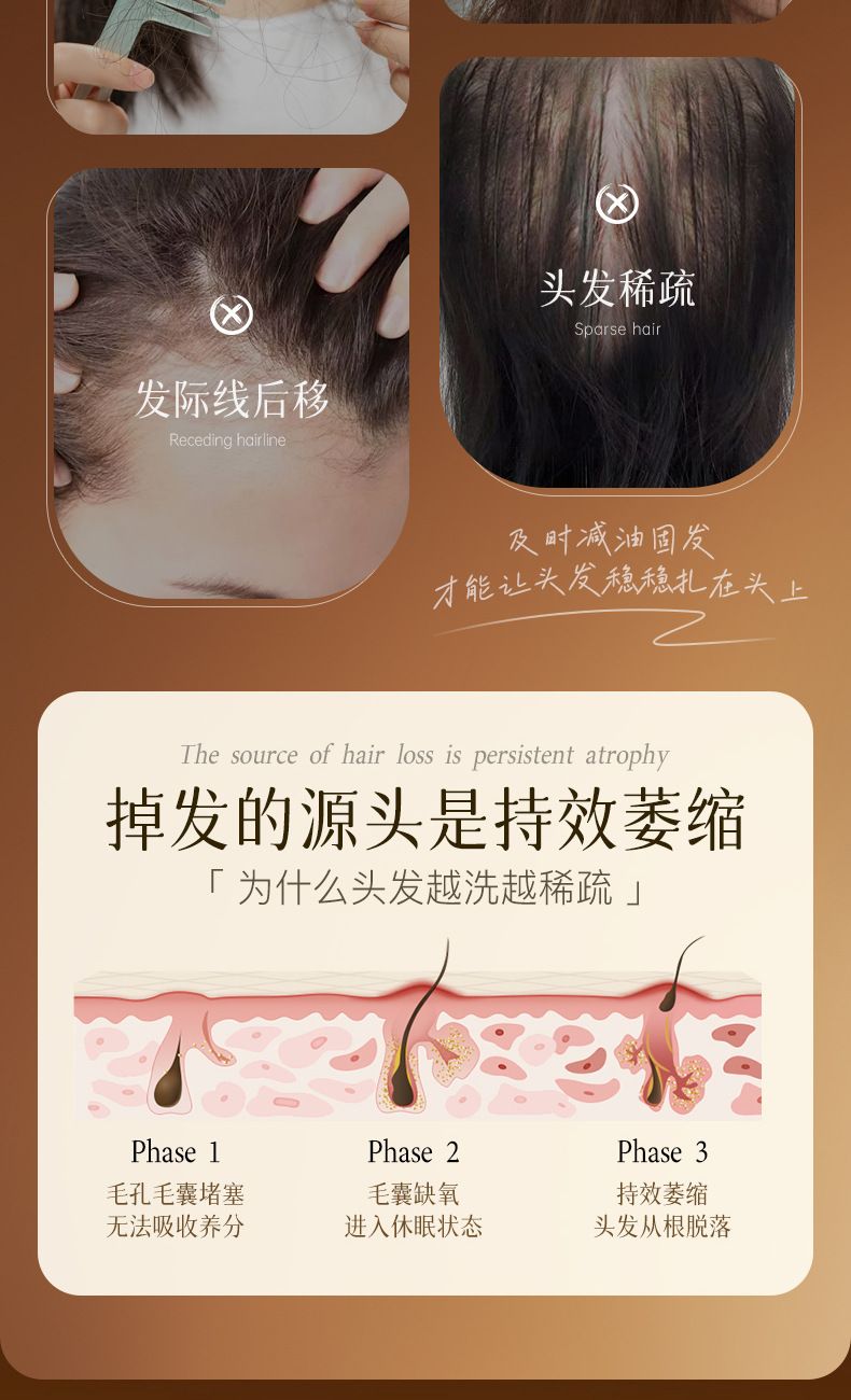 热卖巴宝格侧柏叶生姜何首乌防断发洗发水厂家直销批发一件代发