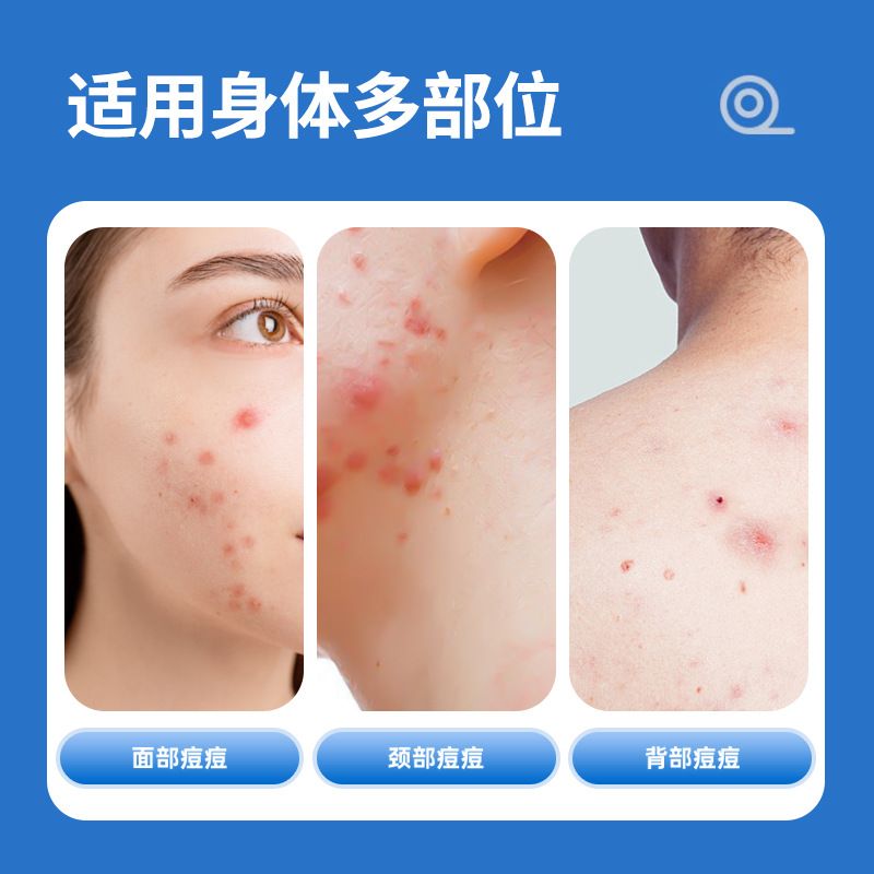 痘痘贴工厂批发遮痘印轻薄净痘透明物理吸附痘贴支持轻定制