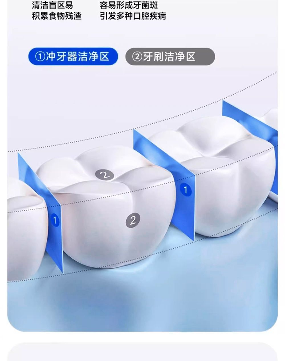 电动高频脉冲冲牙器多功能口腔清洁器洗牙器便携式家用牙齿水牙线