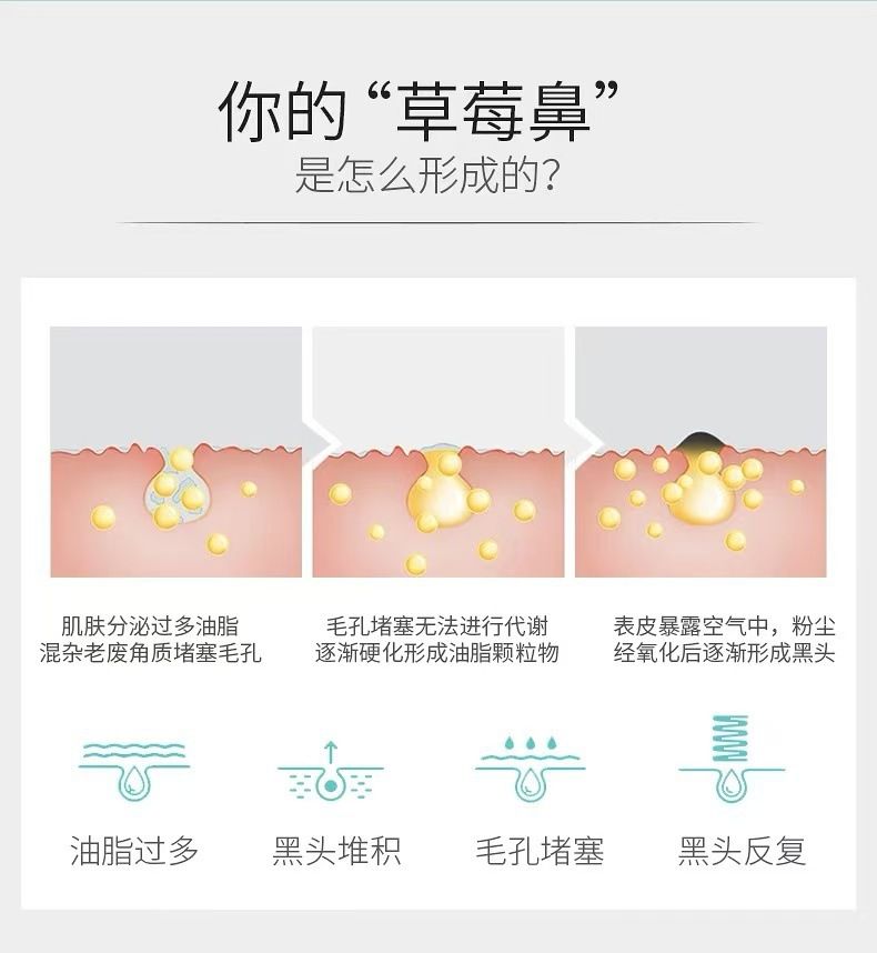 玛贝拉去黑头鼻贴收缩毛孔清洁神器祛吸粉刺鼻子猪鼻贴正品批发