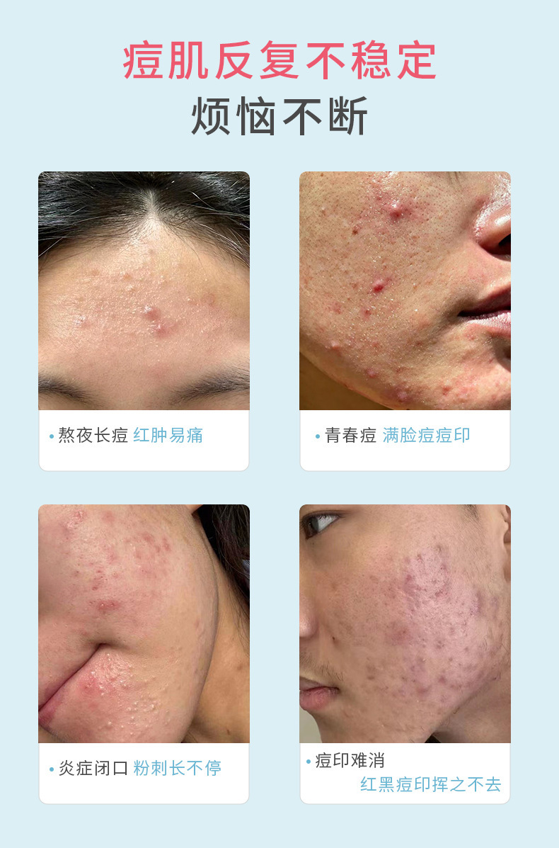 Pimplepatch Heart-Shaped Acne Patches Hydrocolloid Effective