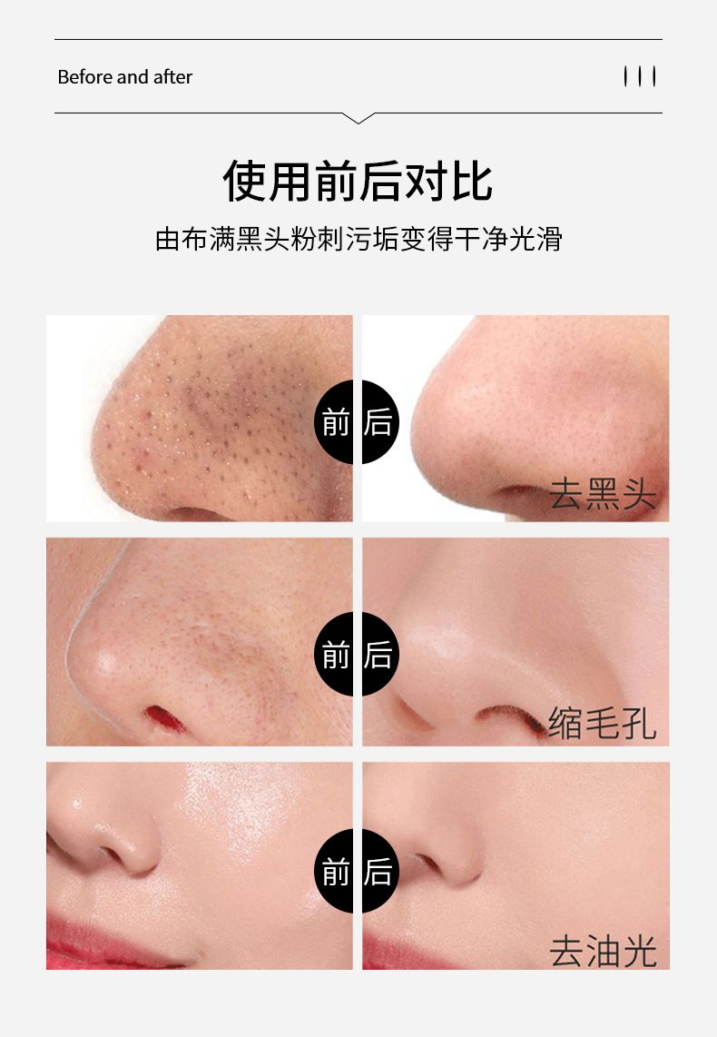 【代发】金妮雅去黑头鼻贴撕拉式粉刺闭口清洁吸贴鼻膜厂家批发