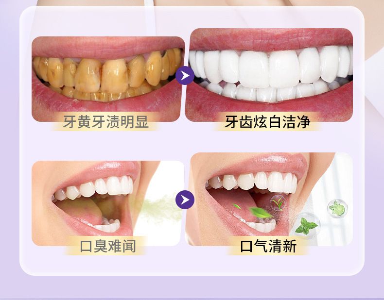 牙科专研去渍美白牙膏清洁牙渍淡黄牙口腔护理清新口气成人牙膏