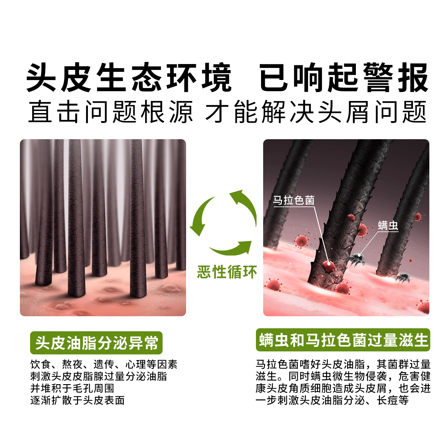 去屑止痒控油洗发水蓬松柔顺滋养洗发露顺滑护发素持久留香沐浴露