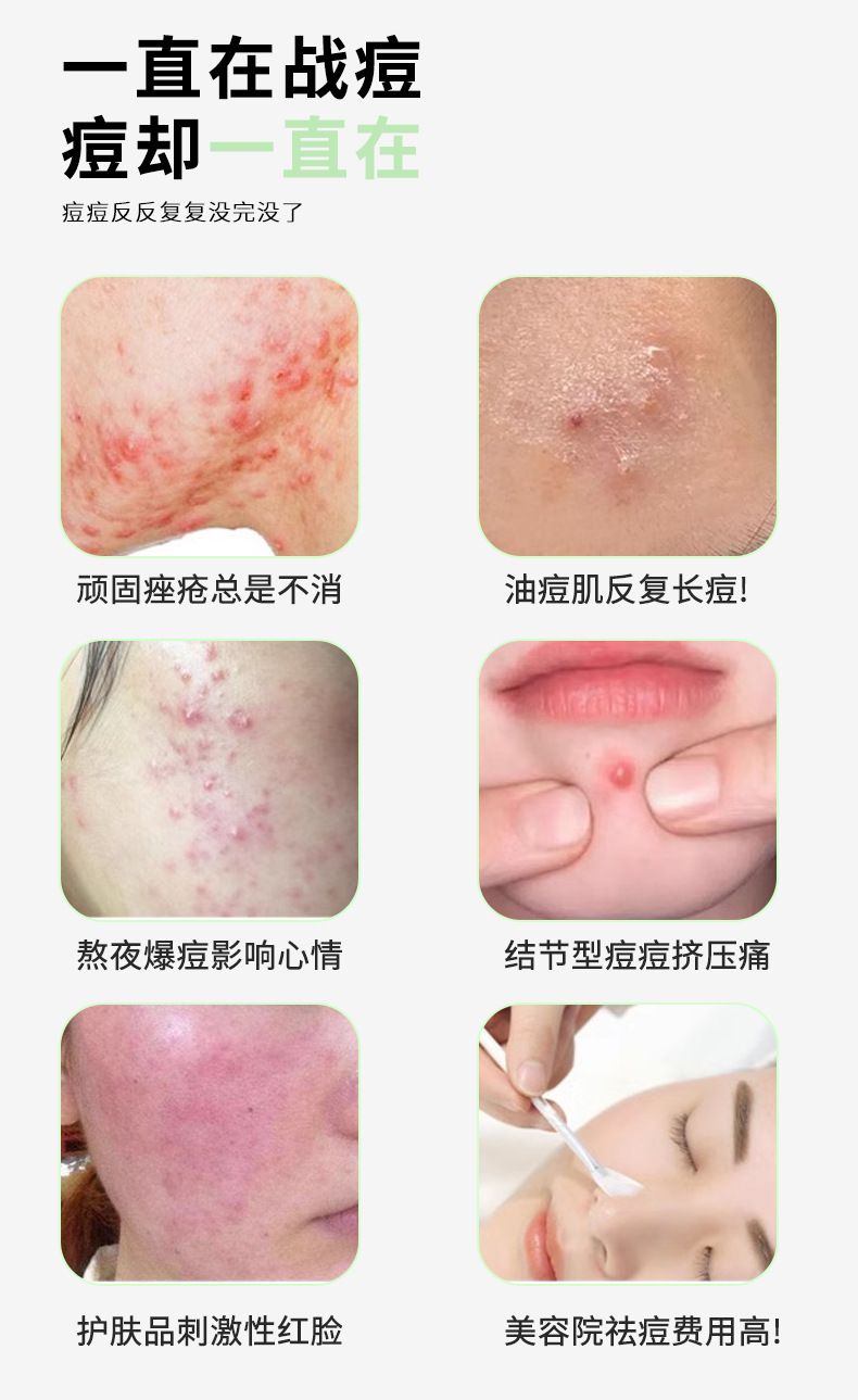 Electronic acne patch with physical pus absorption, lightweight and breathable